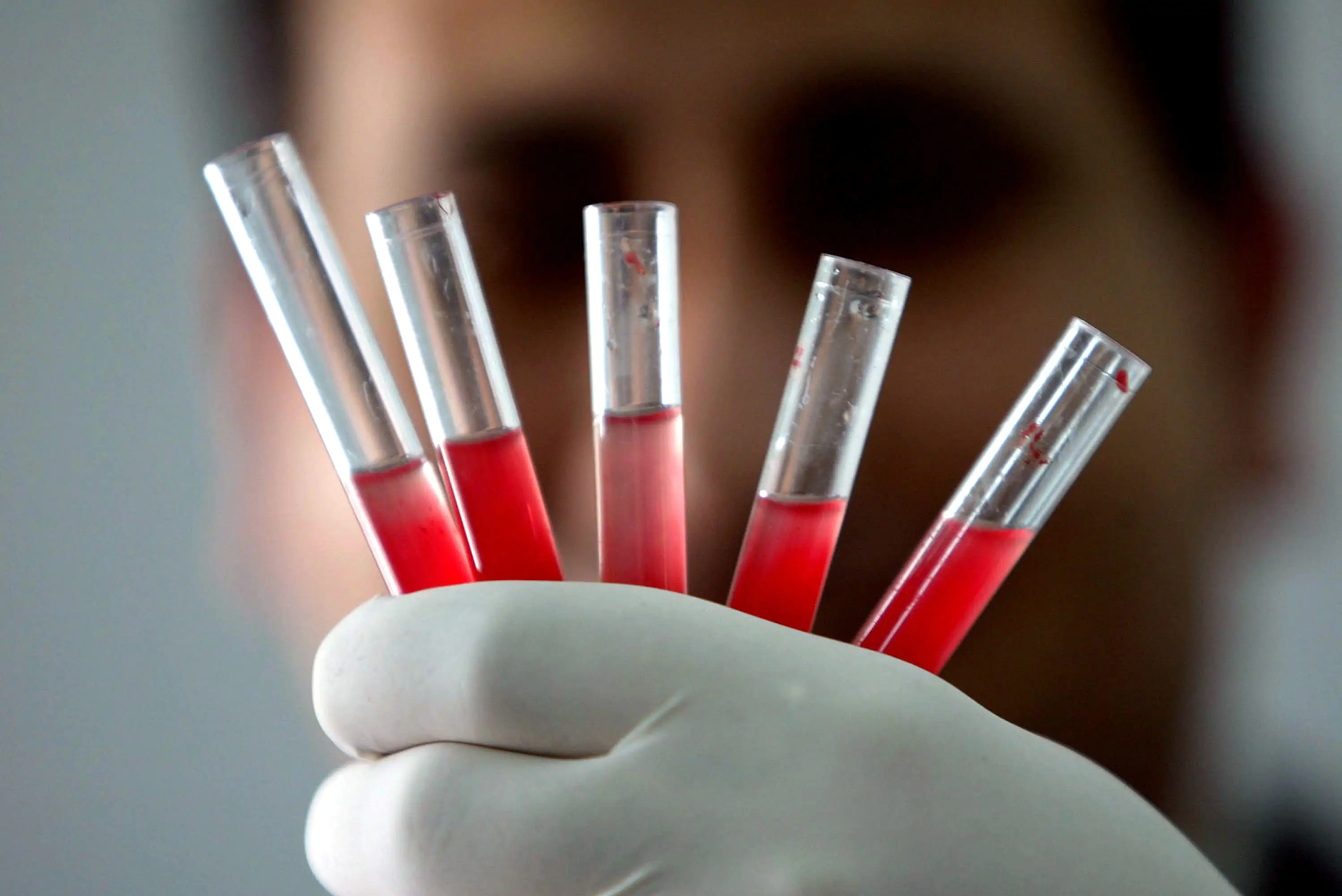 New blood types are often discovered following medical disasters